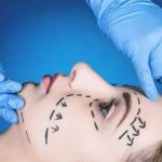 Hackerata una clinica di chirurgia plastica, migliaia di foto di celebrità prima dei loro interventi