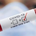 I risultati dei test per coronavirus di 700mila francesi erano di dominio pubblico